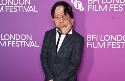 Adam Pearson - October 2026 - Getty Images - BFI London Film Festival BangShowbiz