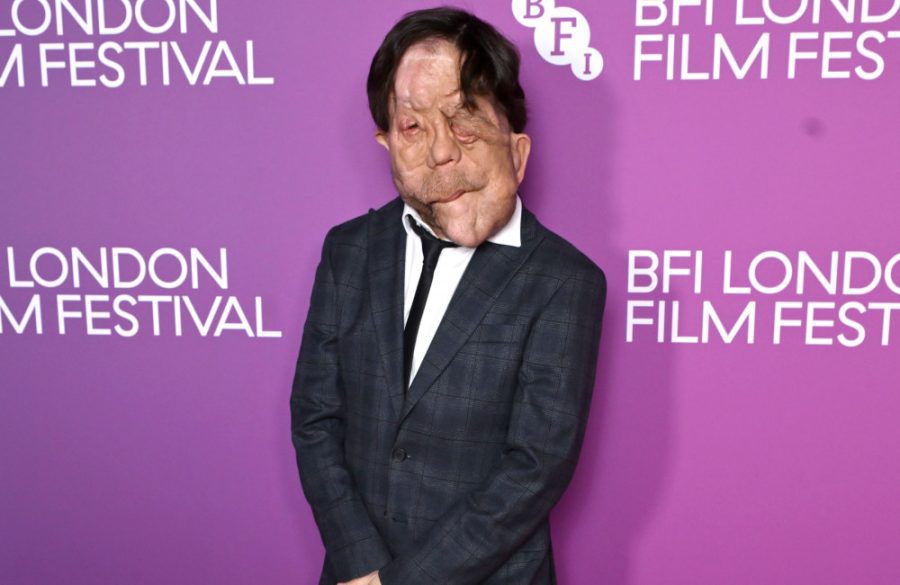 Adam Pearson - October 2026 - Getty Images - BFI London Film Festival BangShowbiz